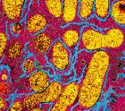 Mitochondria in yellow and pink